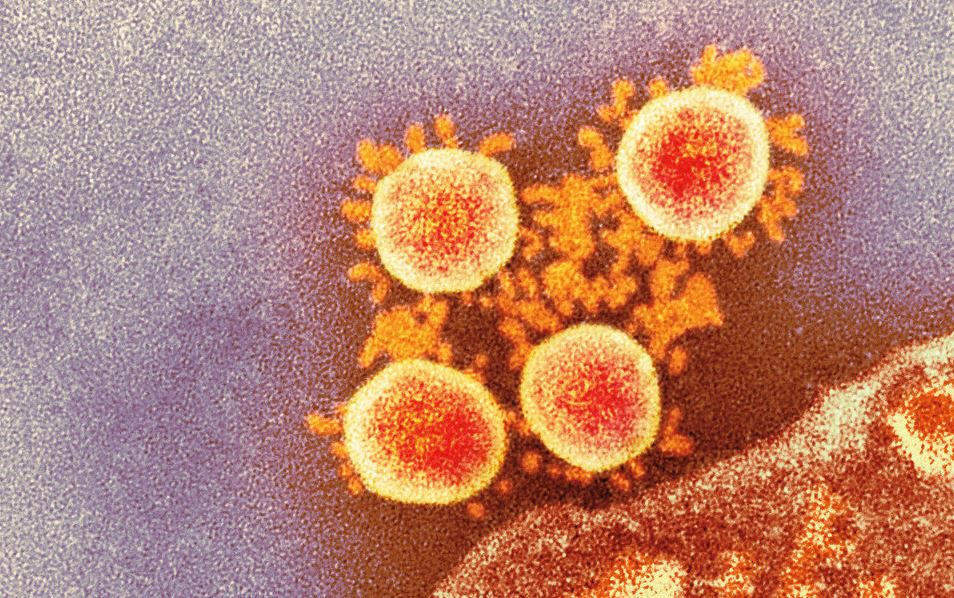 Цветная трансмиссионная электронная микрофотография частиц коронавируса SARS-CoV-2