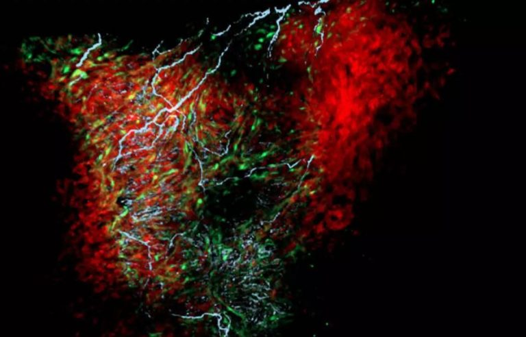 Клетки нексус-глия, обнаруженные в сердце, могут регулировать частоту сердечных сокращений