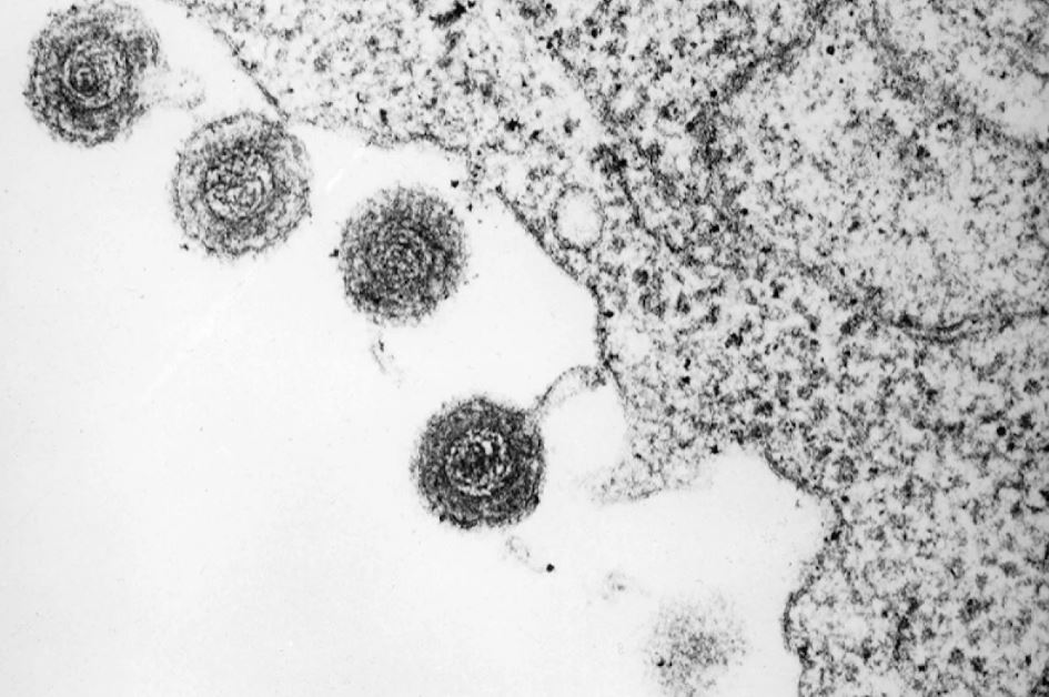 Зараженная клетка высвобождает частицы розеоловируса.