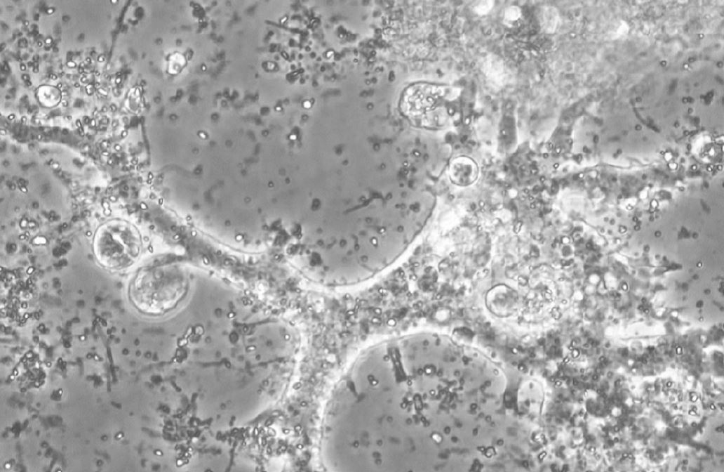 Световая микроскопия Leptomyxa silvatica
