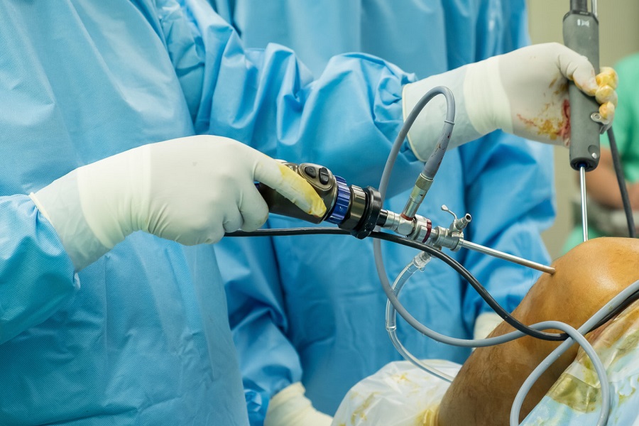 Артроскопия коленного сустава: новейшие достижения малоинвазивной хирургии