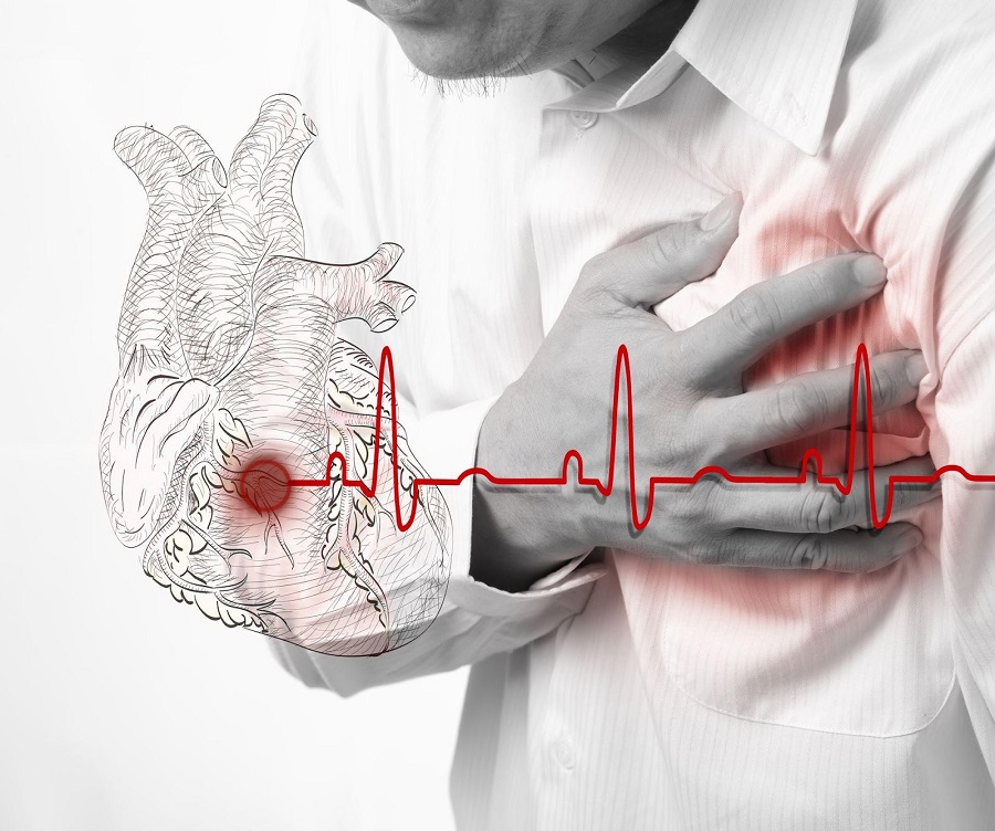 Причины появления ишемической болезни сердца