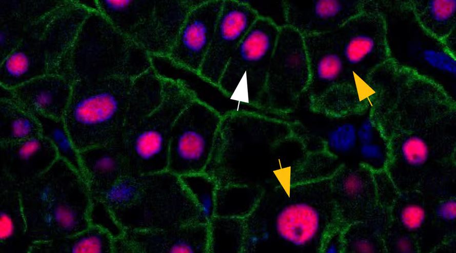 Белые стрелки указывают на клетки печени с обычными двумя наборами хромосом, а желтые стрелки — на клетки, которые накапливают больше
