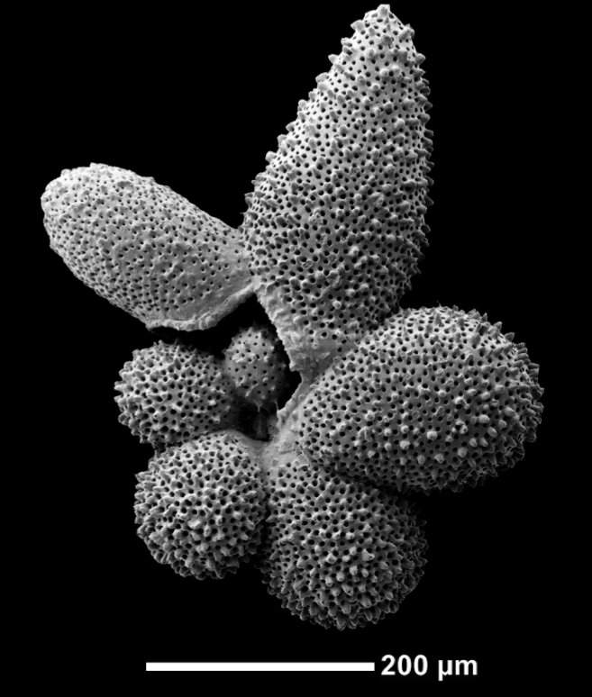 Снимок раковины планктонных фораминифер Globigerinella adamsi 
