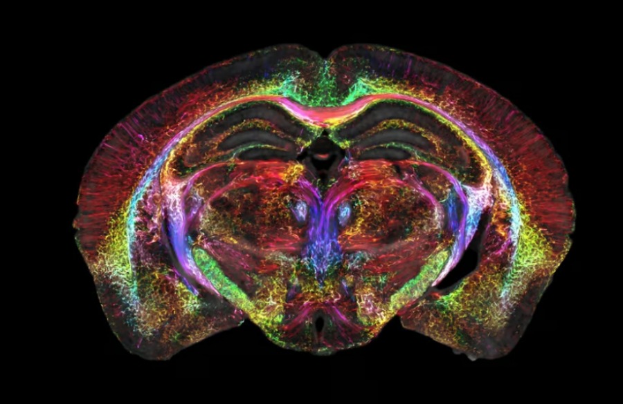 МРТ и световая микроскопия позволили по-новому заглянуть внутрь всего мозга мыши
