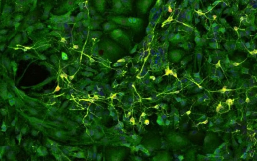 Нейроны гиппокампа 