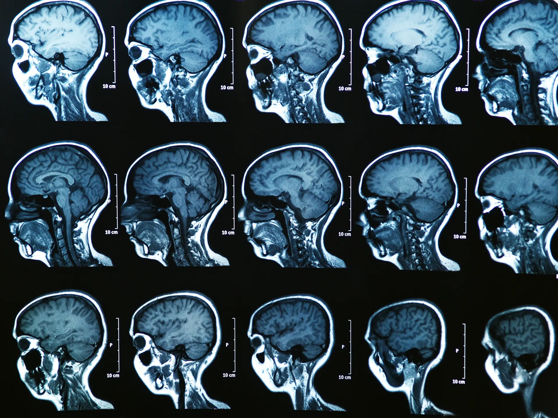 где находится современная технология МРТ для сканирования человеческого мозга