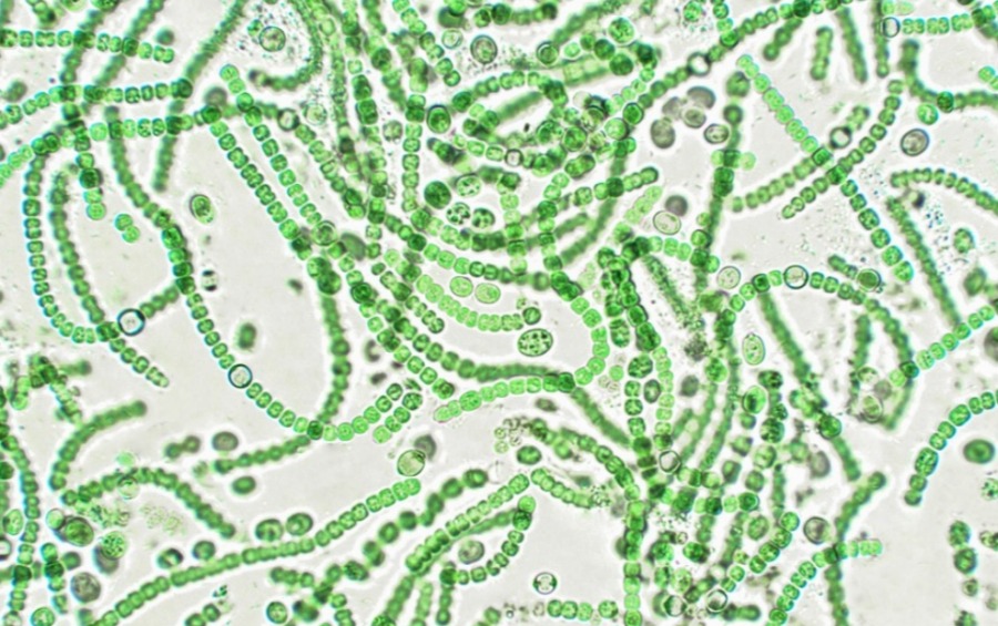 Фотосинтезирующие водоросли под микроскопом 