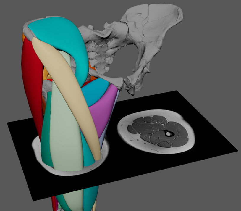 Поперечное сечение подхода к моделированию полигональных мышц, основанного на рубцевании мышц и данных МРТ