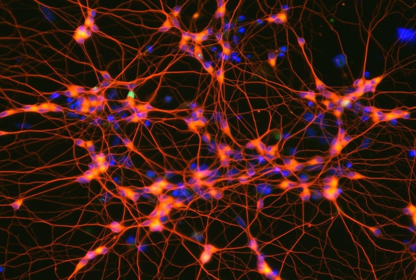 Рисунок №2 Нейронные клетки головного мозга человека.