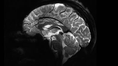 Самый мощный в мире аппарат МРТ сделал первые снимки мозга