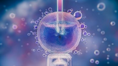 экстракорпоральное оплодотворение