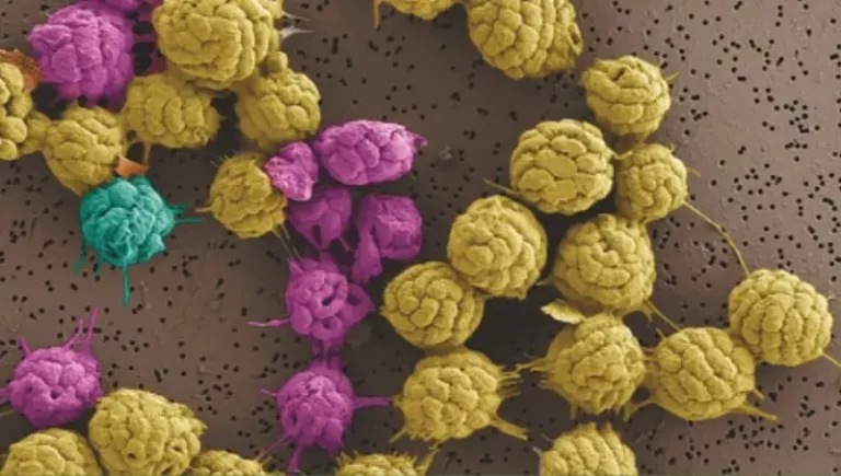 Электронно-микроскопические изображения многоклеточных магнитотактических бактерий