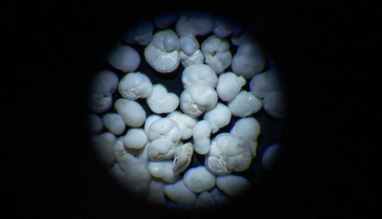 Фораминиферы под микроскопом